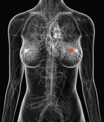 рентгенография груди