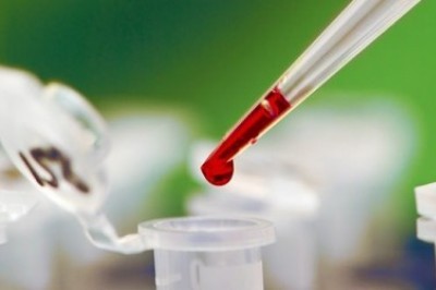 анализ крови на лейкоциты