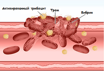 Агрегация тромбоцитов