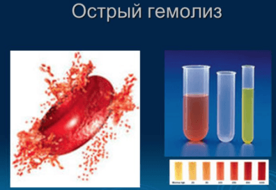 гемолиз крови при проведении реакций на сифилис