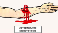 Чем остановить внутреннее кровотечение в домашних условиях 728