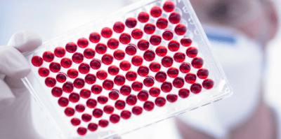 анализ крови на лейкоциты