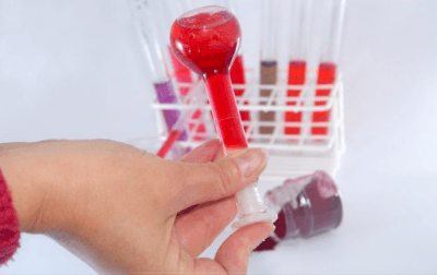 Лейкоциты в крови превышают норму в 2 раза thumbnail
