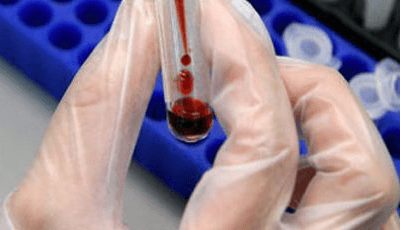 анализ крови на эритроциты у женщины