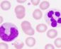 Анализ крови ребенка моноциты норма