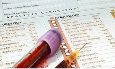 Как посчитать гематокрит по анализу крови