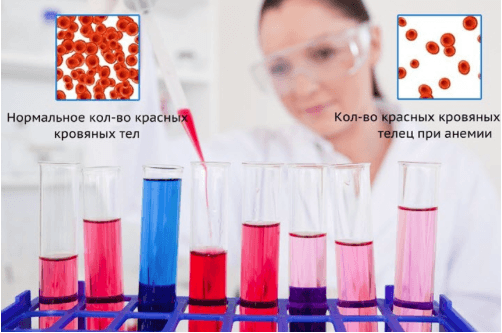 Изменения в общем анализе крови при железодефицитной анемии