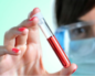 Биохимический анализ крови выявит ли онкологию