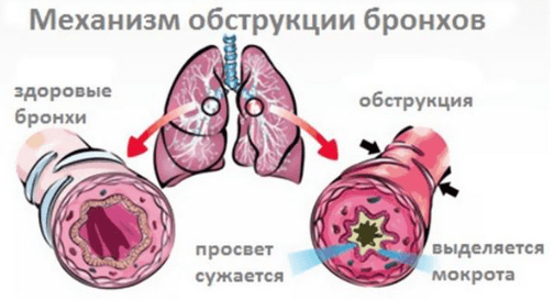 Кровотечение из горла возможные причины