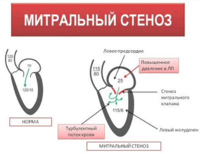 Кровотечение из горла возможные причины