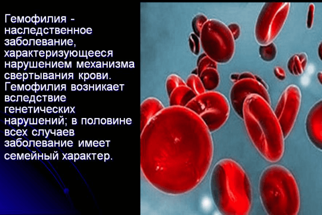 Анализы крови при гемофилии в