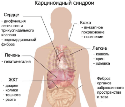 Приток крови к коже лица