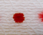 Менструация после сдачи донорской крови